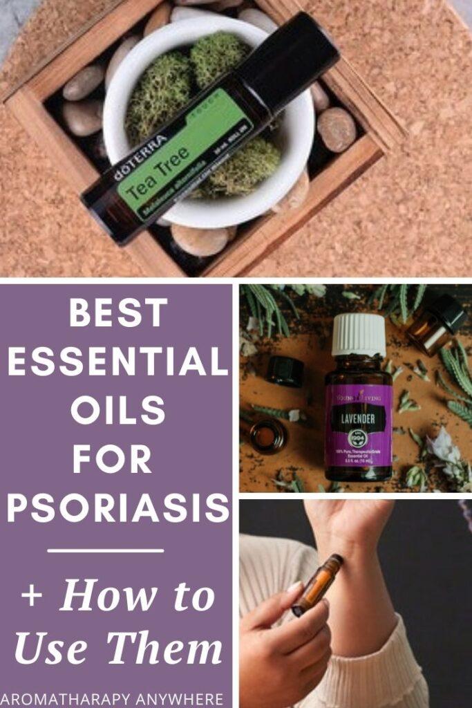 collage of essential oils for psoriasis